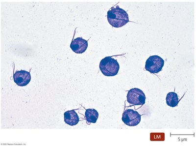 Trichomonas vaginalis trophozoites under light microscopy