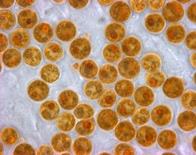 Zooxanthellae cells