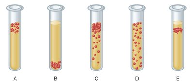 Culture tubes for methanogen identification