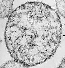 Mycoplasma pneumoniae (no peptidoglycan)