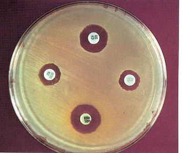 Disk diffusion method showing zones of inhibition around antimicrobial disks