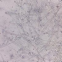Microscopic view of fungal hyphae