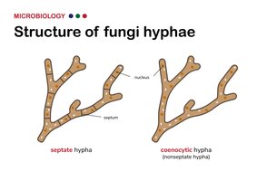 Diagram comparing septate and coenocytic hyphae