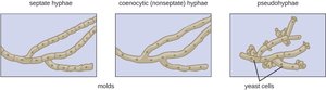 Diagram of septate, coenocytic, and pseudohyphae