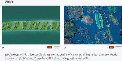LM images of Spirogyra and diatoms