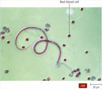 LM image of parasitic worm and red blood cells