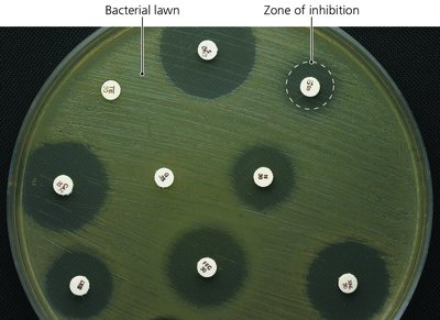 Kirby-Bauer test showing zones of inhibition