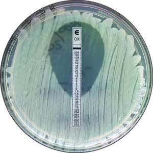 Etest for determining MIC