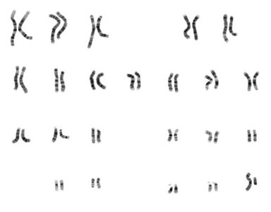 Karyotype of eukaryotic chromosomes
