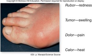 Signs of inflammation