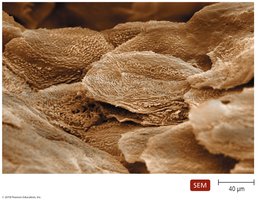 Scanning electron micrograph of human skin surface