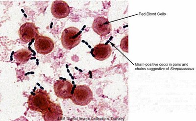 Gram-positive cocci in pairs and chains, Streptococcus species