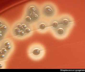 Streptococcus pyogenes colonies on agar