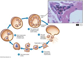 Pneumocystis in lung tissue