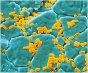 Salmonella enterica bacteria on a surface