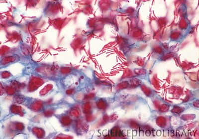 Gram positive spore-forming bacteria in tissue