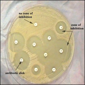 Kirby Bauer antibiotic disk test