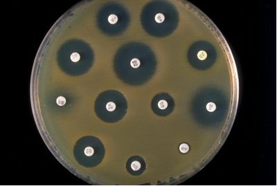 Kirby Bauer antibiotic disk test with zones of inhibition