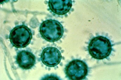 Histoplasma capsulatum spores