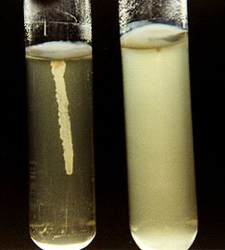 Semisolid motility medium: motile vs non-motile