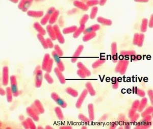 Endospore stain: endospore and vegetative cell