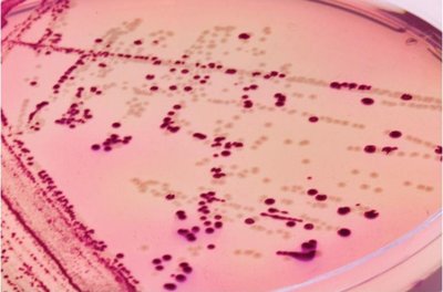 MacConkey agar with isolated colonies