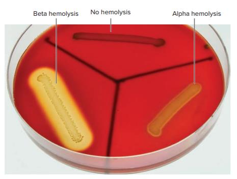Blood agar showing hemolysis types