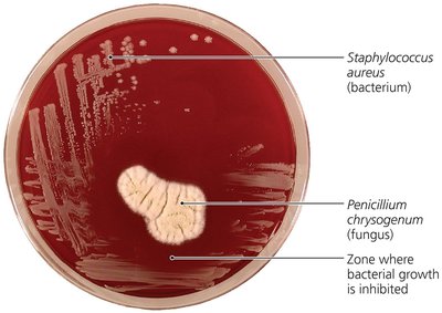 Penicillium chrysogenum inhibiting Staphylococcus aureus on agar plate
