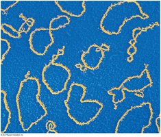 Electron micrograph of bacterial plasmids