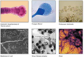 Examples of major groups of microorganisms