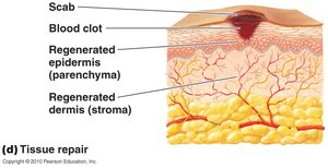 Tissue repair after inflammation