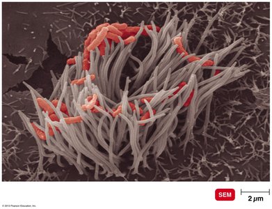 Bordetella pertussis infecting ciliated cells