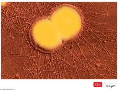 SEM of Neisseria gonorrhoeae with fimbriae and capsule