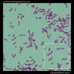 Campylobacter jejuni