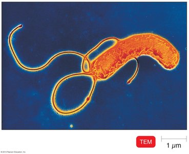 Helicobacter pylori with flagella