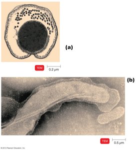 Spirochete structure with axial filaments