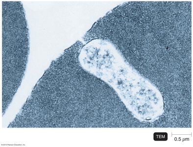 TEM of Bartonella henselae in a red blood cell