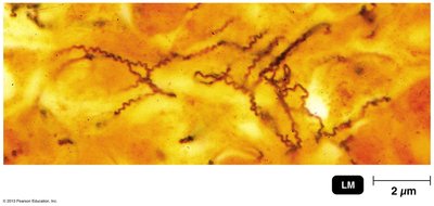 Treponema pallidum, cause of syphilis