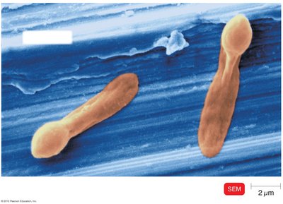 Clostridium difficile endospore