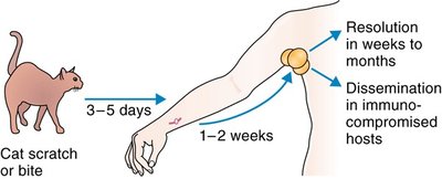 Cat-scratch disease transmission and progression
