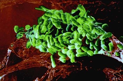 SEM of Rickettsia prowazekii