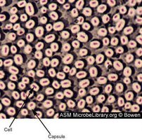 Bacterial capsules visualized around cells