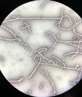 Microscopic image of Bacillus cereus chains under negative stain
