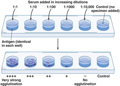 The use of agglutination to quantify antibody in a sample