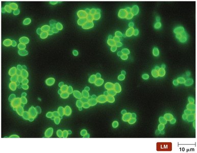 The direct fluorescent antibody test