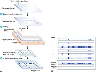 A western blot