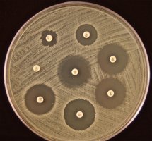 Kirby-Bauer test showing zones of inhibition