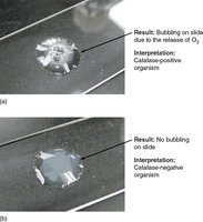 Catalase test: bubbling (positive) and no bubbling (negative)