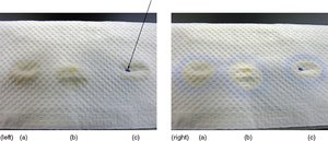Oxidase test: blue dot indicates positive result