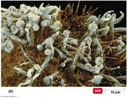 SEM of fungal structures